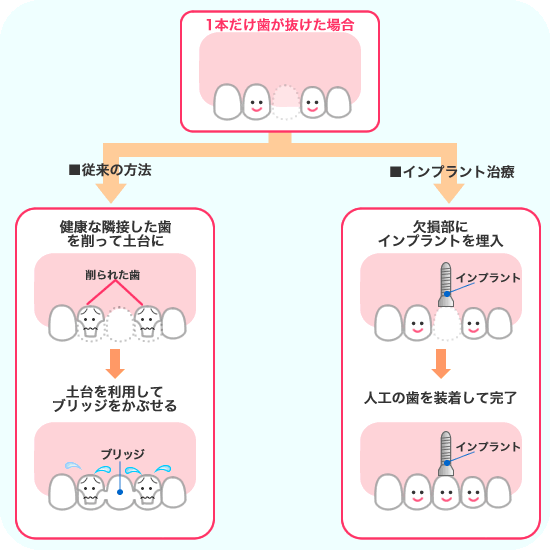 Cvg1{ꍇ