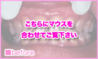 zCgjOp