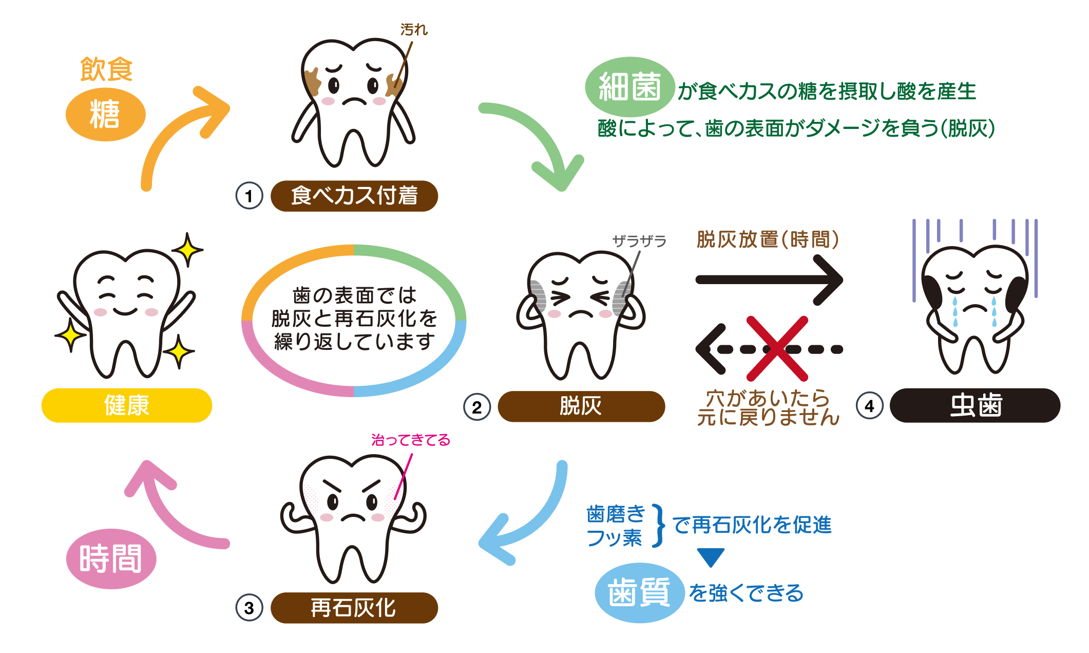 虫歯は脱灰が細菌によって進行することでできる!