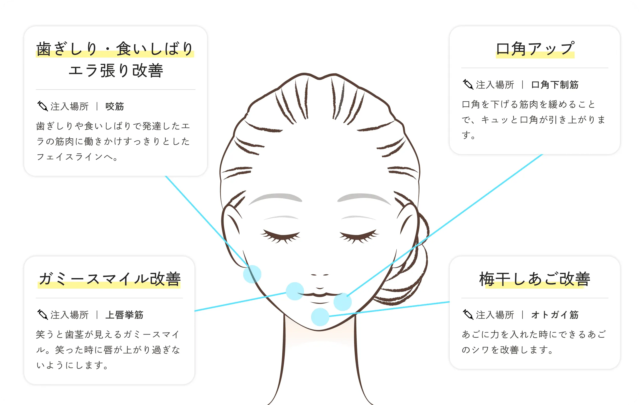 歯科ボツリヌスの「効果」