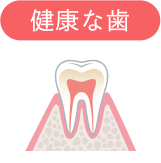 健康な歯