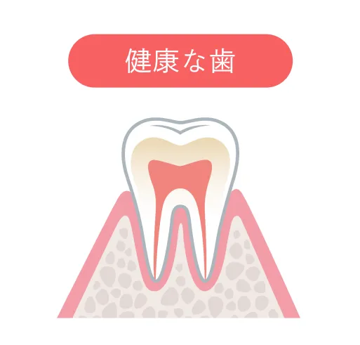 健康な歯